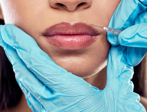 The Complete Guide to Fillers: Beauty in a Syringe