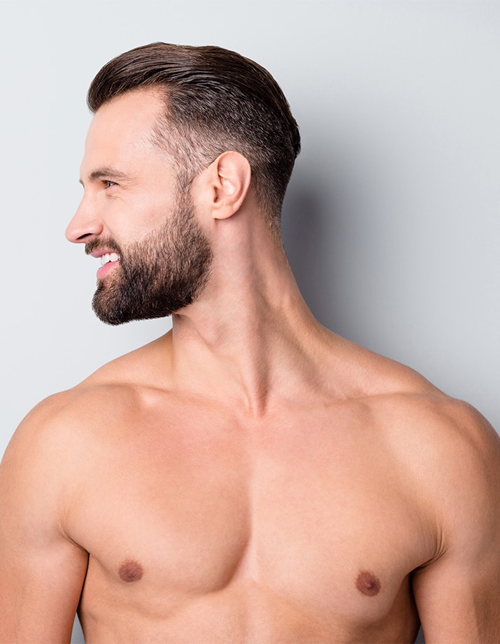 Gynecomastia