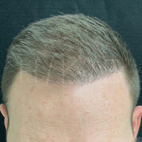 After